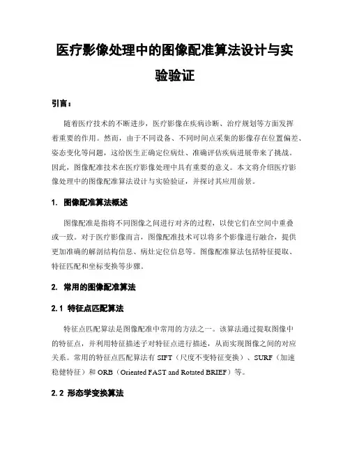 医疗影像处理中的图像配准算法设计与实验验证