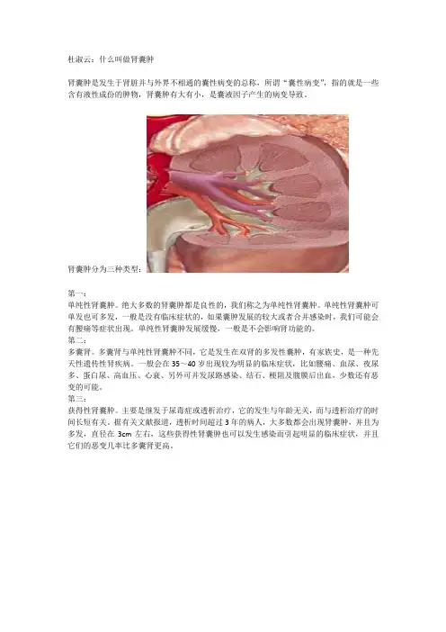 肾病中医专家杜淑云带您走进了解肾囊肿