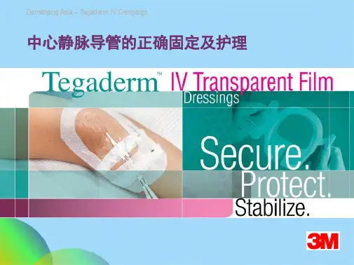业务学习各种管道的固定固定ppt(共37张PPT)