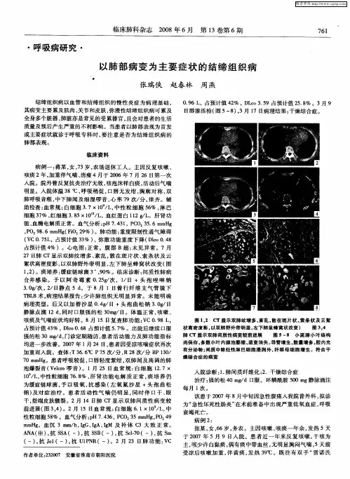 以肺部病变为主要症状的结缔组织病