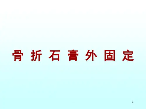 (医学课件)骨折石膏外固定详解ppt演示课件