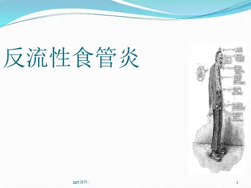反流性食管炎ppt课件