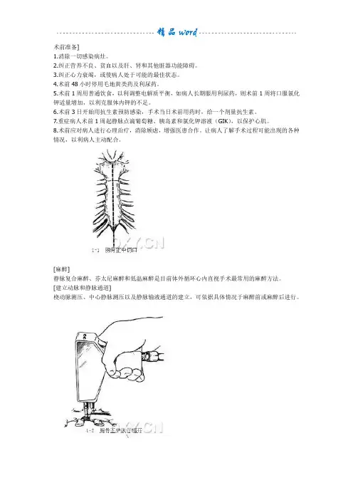 体外循环建立步骤