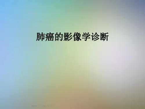 肺癌的影像学诊断