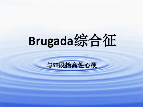 Brugada综合征ppt课件