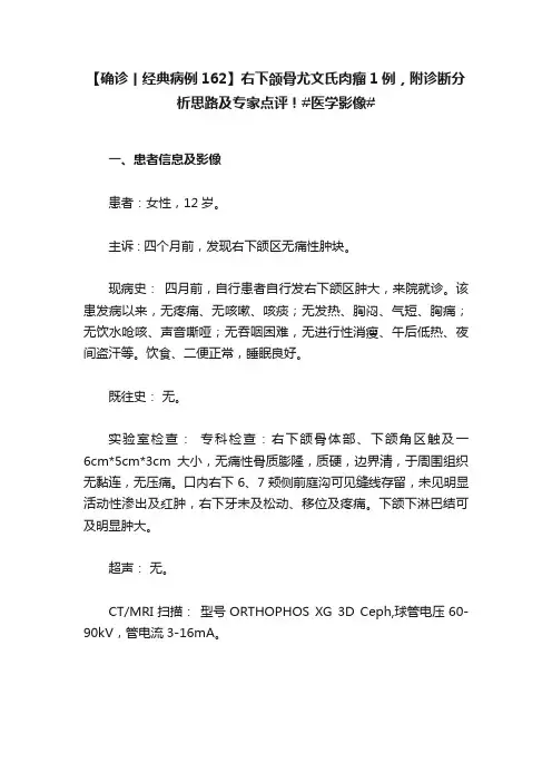 【确诊丨经典病例162】右下颌骨尤文氏肉瘤1例，附诊断分析思路及专家点评！#医学影像#