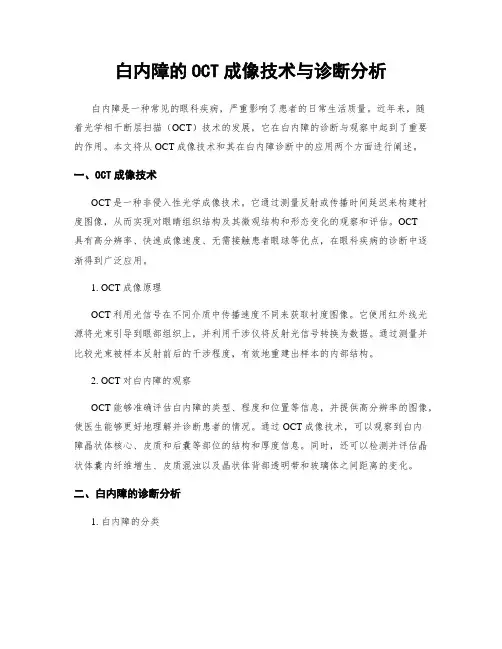 白内障的OCT成像技术与诊断分析