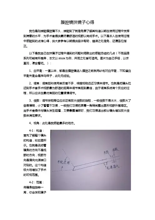 腹腔镜扶镜子心得