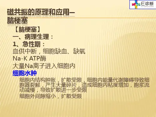 全身类PET肿瘤筛查-脑梗塞的DWI图像