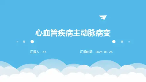 心血管疾病主动脉病变