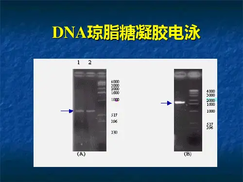 生物化学经典实验DNA琼脂糖凝胶电泳的原理、步骤、试剂配制、结果分析分析