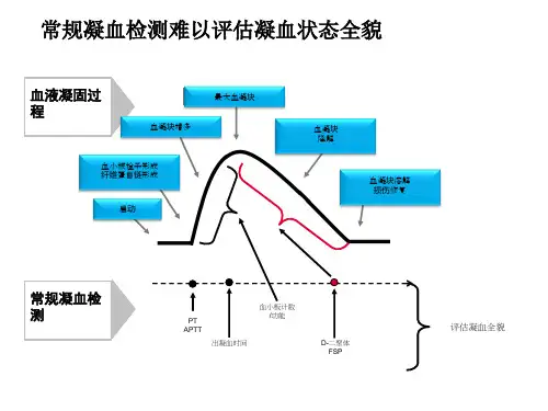 TEG血栓弹力图在骨科围术期的应用课件