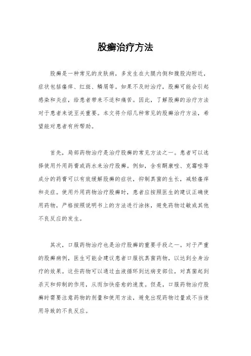 股癣治疗方法