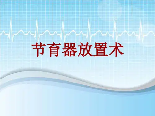 手术讲解模板：节育器放置术