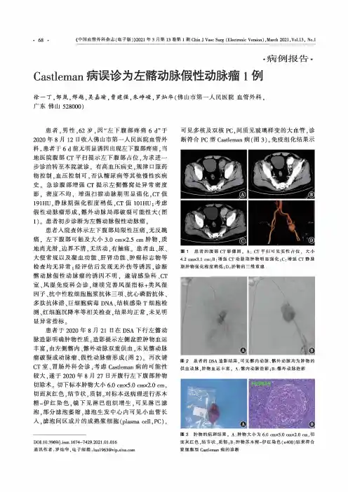 Castleman病误诊为左髂动脉假性动脉瘤1例