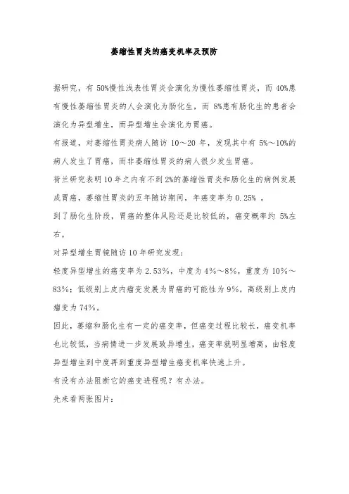 萎缩性胃炎的癌变机率及预防