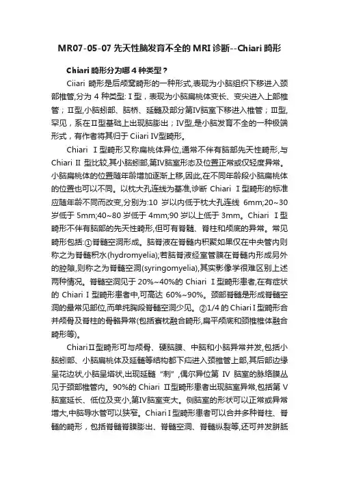 MR07-05-07先天性脑发育不全的MRI诊断--Chiari畸形