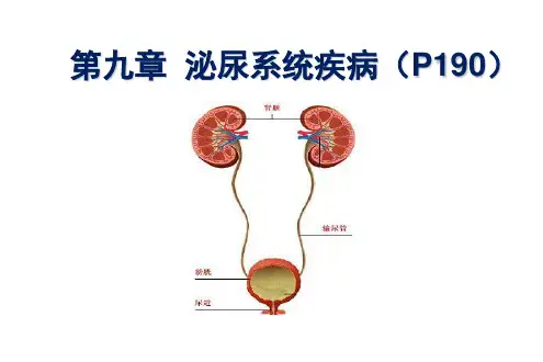 9.1 病理学-肾小球肾炎