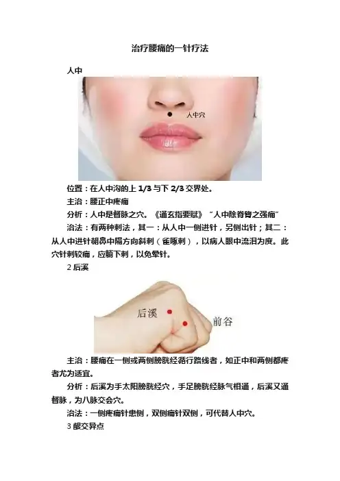 治疗腰痛的一针疗法