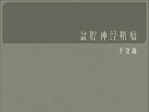 盆腔神经鞘瘤