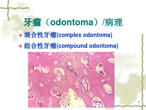 牙源性肿瘤OdontogenicTumors