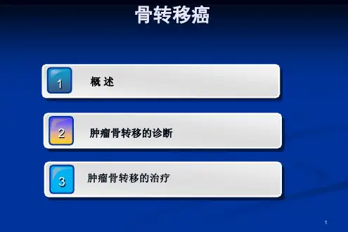 骨转移治疗ppt课件