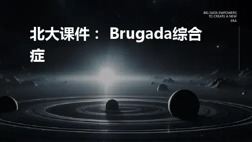 北大课件Brugada综合症