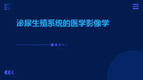 (医学课件)泌尿生殖系统的医学影像学