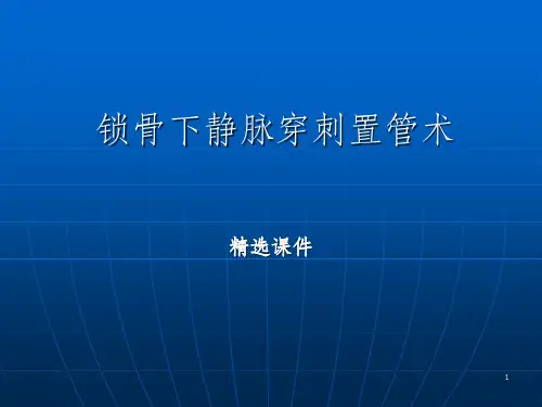 锁骨下静脉穿刺置管术 (2)