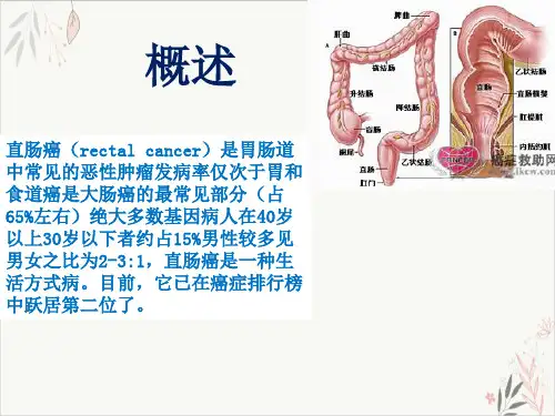 消化内科护理查房PPT.