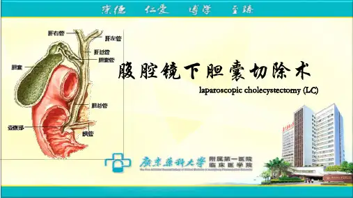 腹腔镜胆囊切除术(详细讲解)
