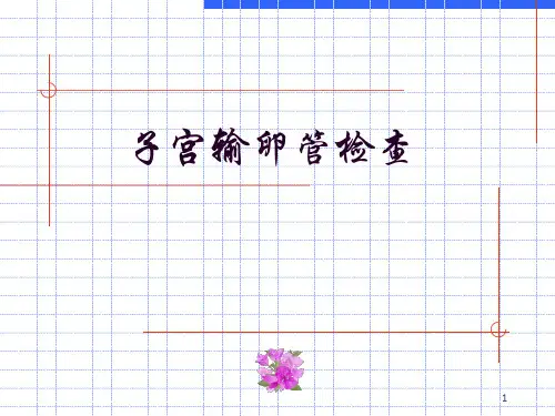 子宫造影PPT演示课件