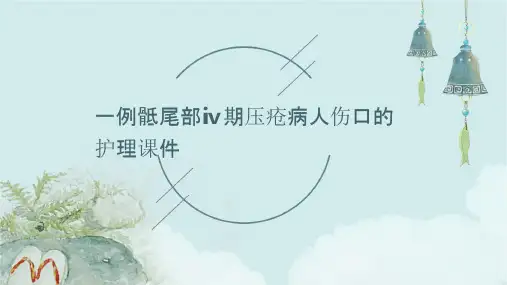 一例骶尾部Ⅳ期压疮病人伤口的护理课件