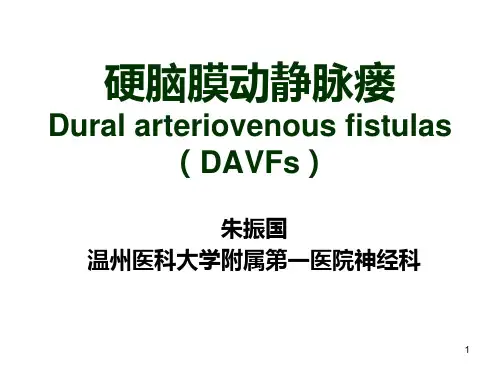 硬脑膜动静脉瘘PPT课件