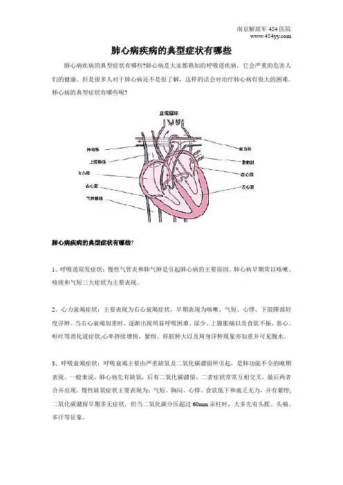肺心病疾病的典型症状有哪些