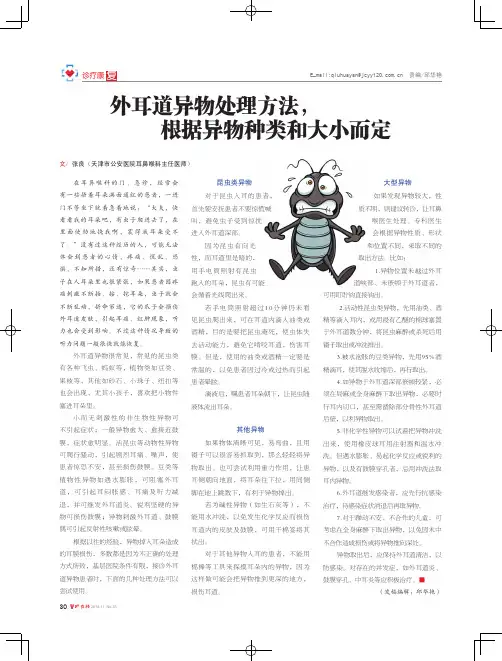 外耳道异物处理方法,根据异物种类和大小而定