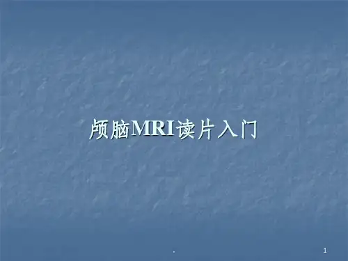 颅脑MRI读片入门ppt课件