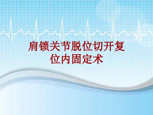 手术讲解模板：肩锁关节脱位切开复位内固定术