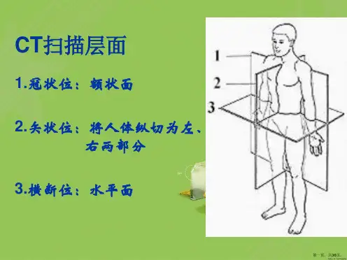 头部CT基础及断面解剖