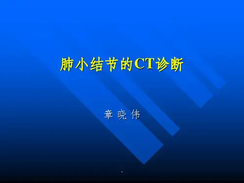 肺结节ppt课件