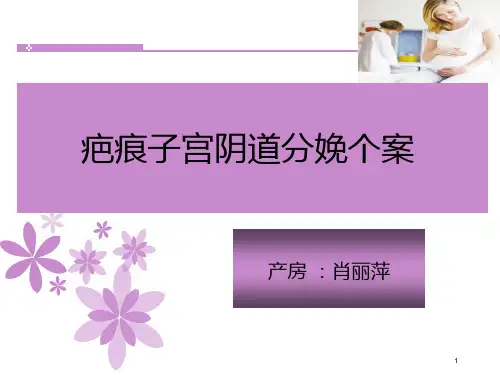 疤痕子宫顺产护理查房 PPT课件