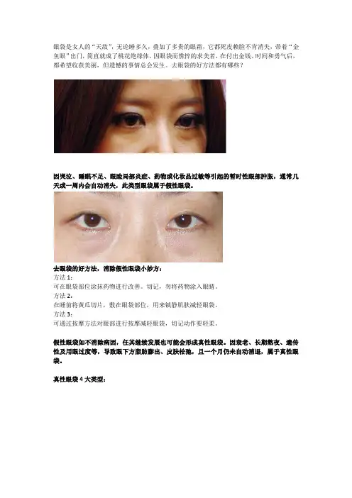 去眼袋的好方法