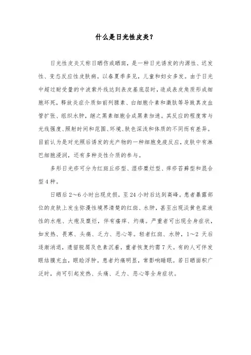什么是日光性皮炎？