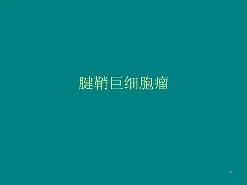 腱鞘巨细胞瘤影像表现