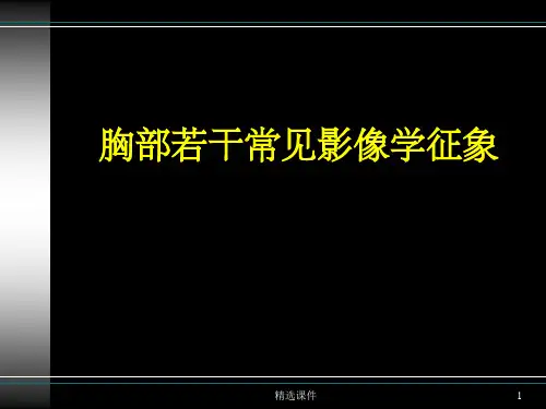胸部疾病常见影像学征象ppt课件