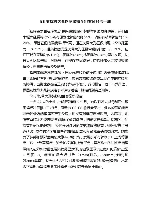 55岁枕骨大孔区脑膜瘤全切案例报告一则
