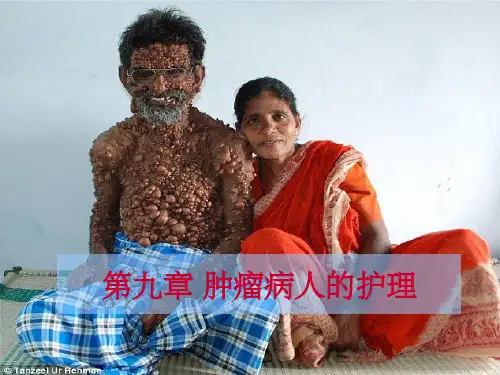 《肿瘤病人的护理》PPT课件