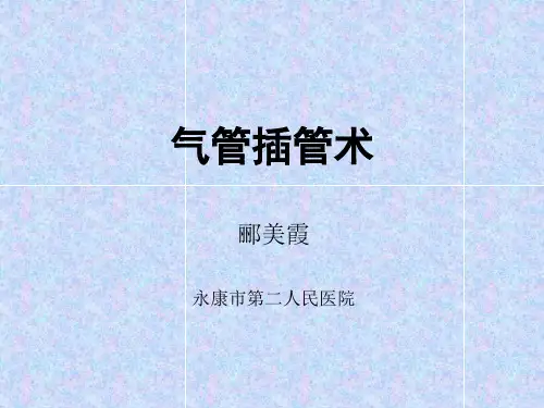 气管插管术