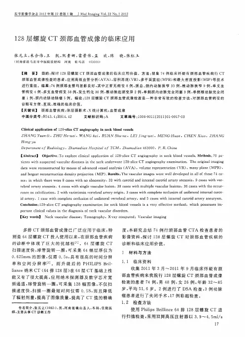 128层螺旋CT颈部血管成像的临床应用