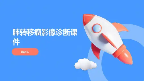 肺转移瘤影像诊断课件